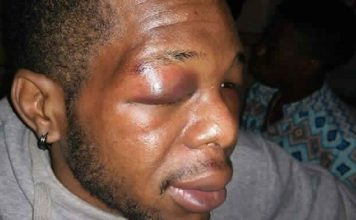 Tunisie : des Ivoiriens lynchent dont plusieurs dans le coma